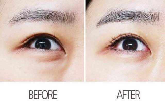[12ml]Kem mắt  thâm xóa nhăn mắt Ahc