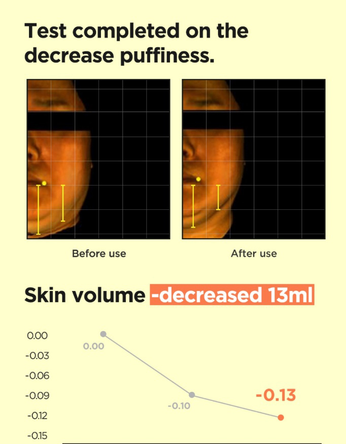 [Nhacuabeautyholic] Mặt nạ thon gọn mặt ISNTREE PUFFY FACE FIT COOLING MASK