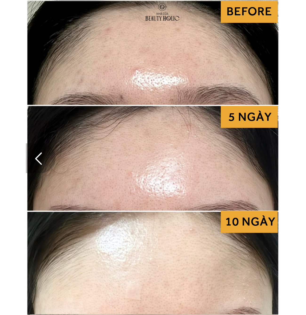 [Nhacuabeautyholic] Bột rửa mặt NEEDLY MILD ENZYME CLEANSING POWDER