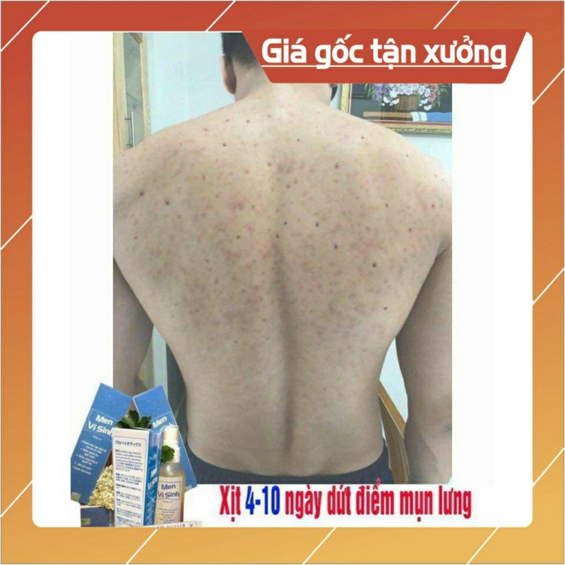Nếu bạn đang khổ sở vì viêm nang lông, mụn lưng gây ngứa ngáy khó chịu, mụn thâm mất thẩm mỹ – Tavida Cam kết giúp bạn thoát khỏi vĩnh viễn sau 2 tuần giá rẻ