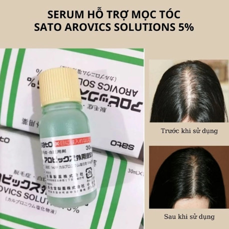 Tinh Chất Bôi Kích Thích Mọc Tóc Thảo Dược SATO 30ml