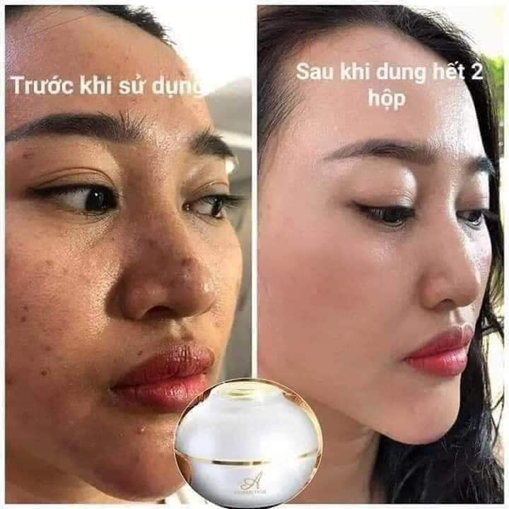 KEM FACE PHÁP A COMESTIC ( mẫu mới)