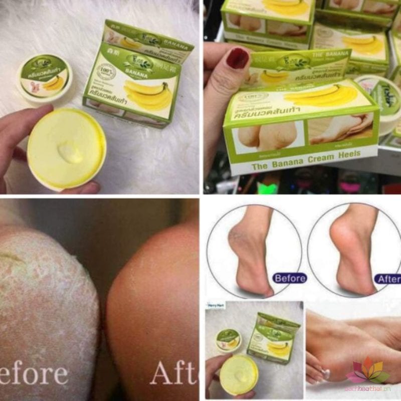 Kem chuối  nứt gót chân Thái Lan 30g
