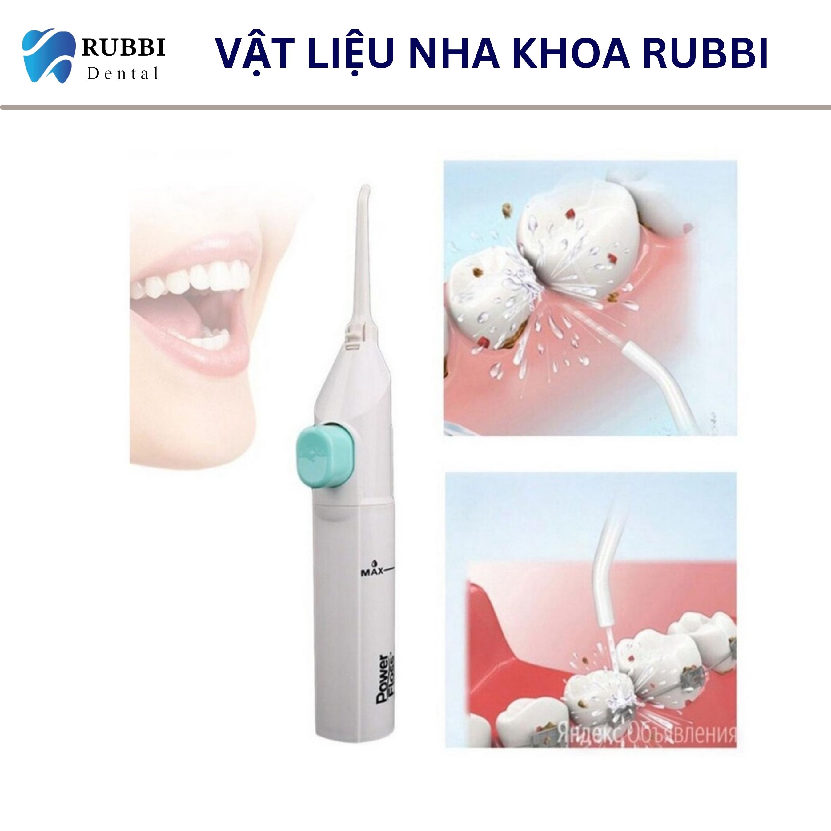 Máy tăm nước cơ, vệ sinh răng miệng Power Floss