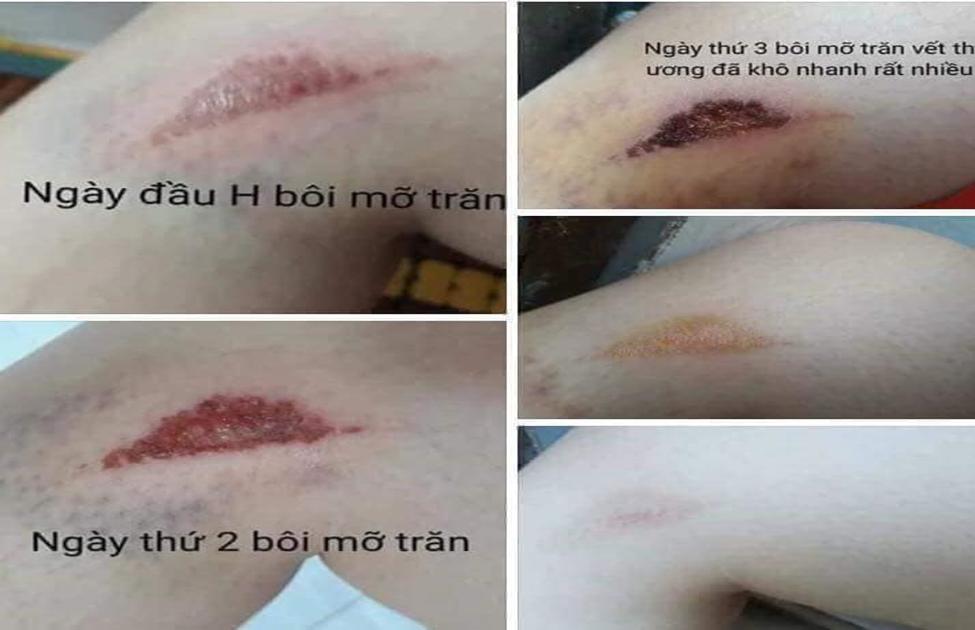 [HCM]MỠ TRĂN NGUYÊN CHẤT NSTORE BY THANH NHI