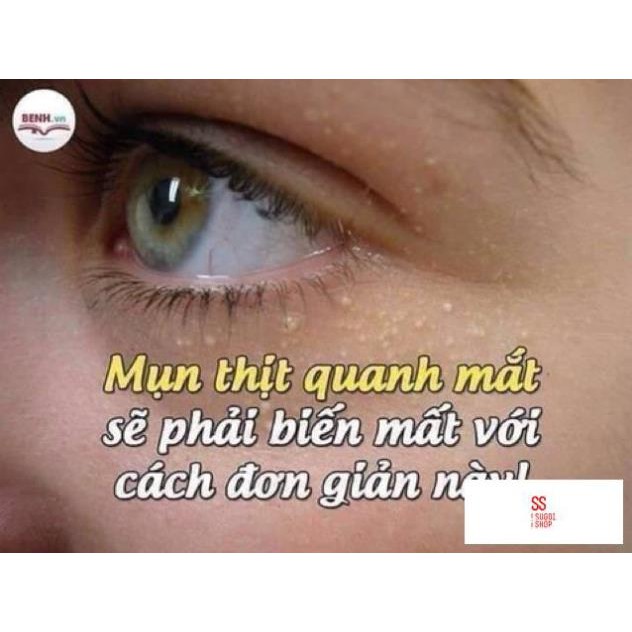 Kem thoa mụn thịt Tsubuporon Nhật Bản