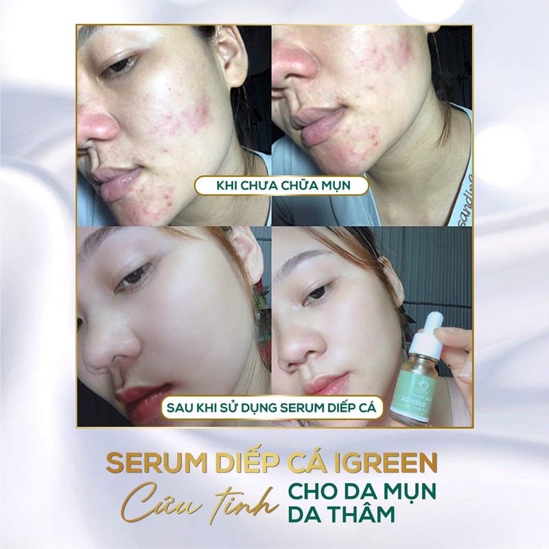 Serum Diếp Cá