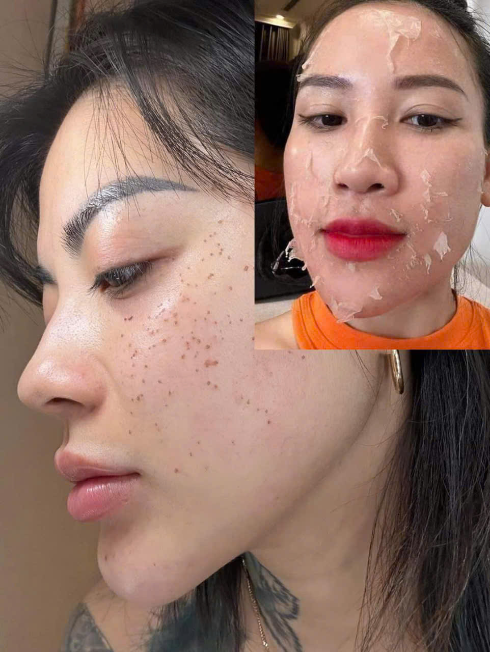 [Chính Hãng].Chấm Tàn Nhang không đau rát Yody Phương Anh dạng gel phù hợp với mọi loại da
