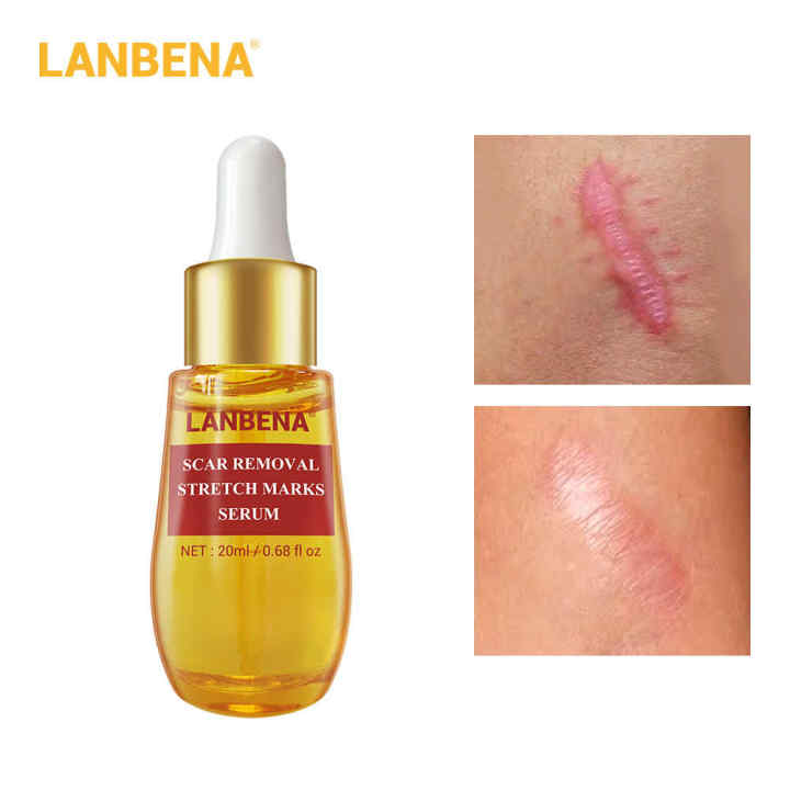 Tinh Chất Làm Mờ Sẹo Cấp Ẩm Làm Mờ Sẹo Giảm Thâm Mụn Sẹo Lâu Năm Scar Treatment Serum Lanbena 20Ml