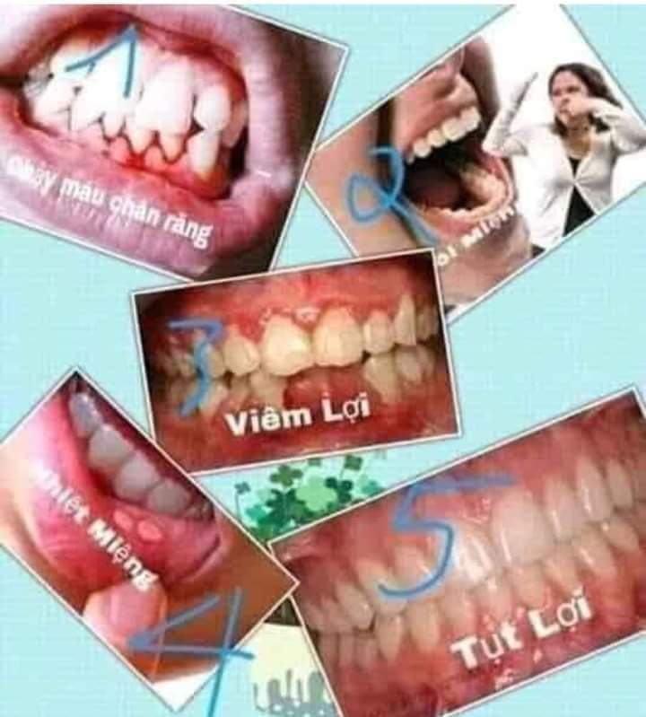 2 chai SAU RANG TINH DAU DA THAO LIEN 20ml