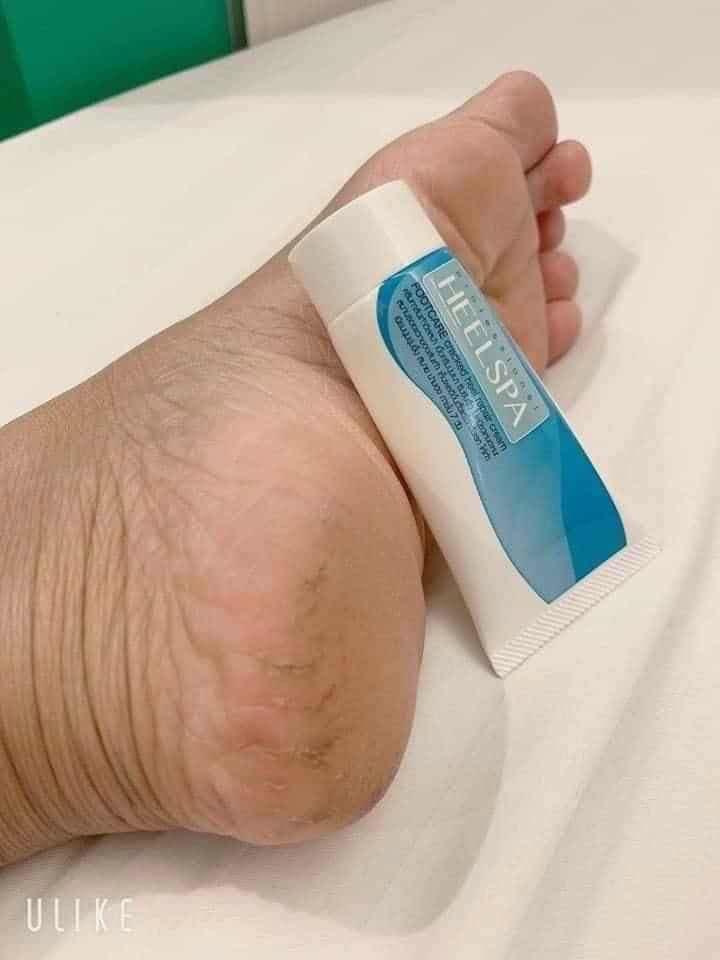 [HCM] Kem bôi nứt gót chân làm mềm da HEELSPA Thái Lan