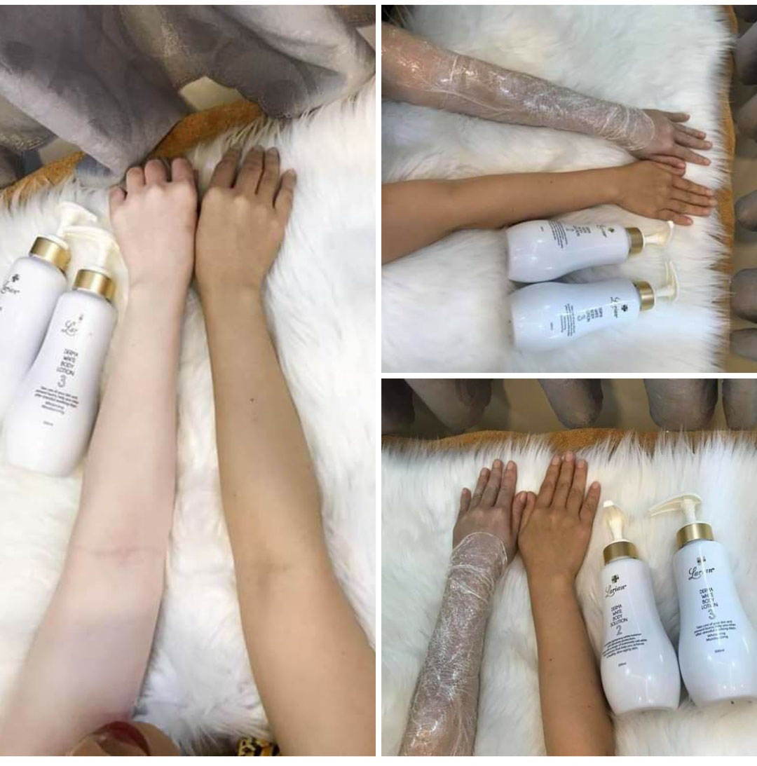 Kem ủ trắng body Larian Derma White Body Solution