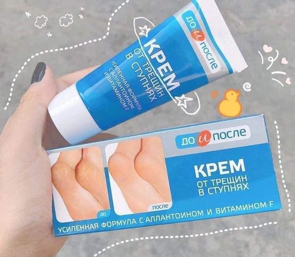 Kpem Apteka Russian Cracked Heel Cream