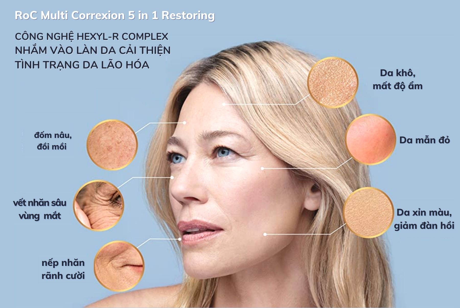 Kem dưỡng RoC Multi Correxion 5 IN 1 Daily Moisturizer SPF 30 (50mL)