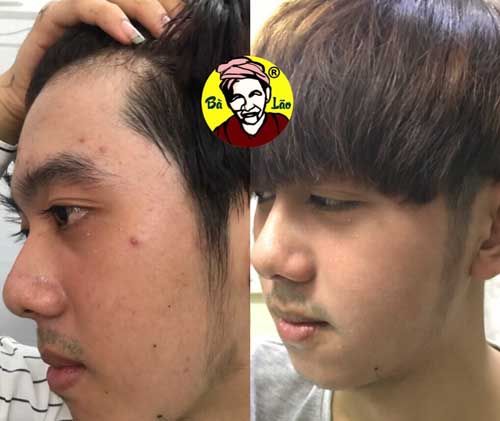 [HCM]Tái Tạo Cao Cấp - Serum Bà Lão