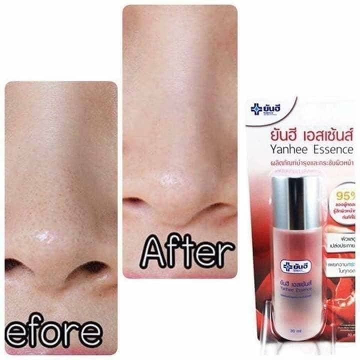 Nước Hoa Hồng YANHEE ESSENCE Thái Lan