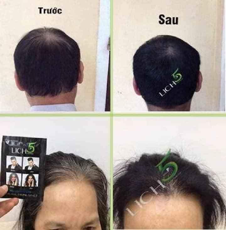 Dầu gội thảo dược Lich5 - Phủ bạc trong 5 phút