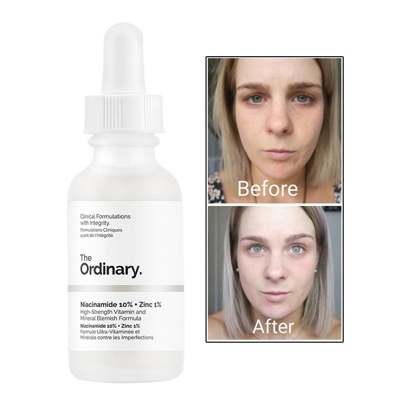 [HCM](Bill Mỹ-USA) Tinh Chất Niacinamide 10% + ZinC 1% - The Ordinary