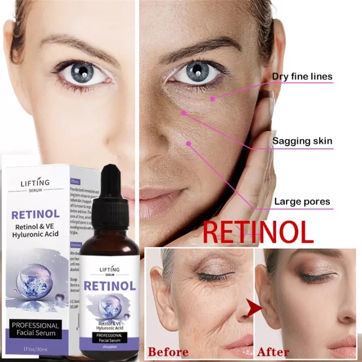 Retinol Facial Serum 30ML Vitamin E Whitening Anti Wrinkle Remove Dark Spots Face Essence Anti-Aging Serum 30ml