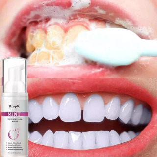 RtopR Bọt Tẩy Trắng Răng Làm Sạch Răng Khử Mùi Hôi Miệng Mousse Teeth Whitening Clean Teeth 60ml thumbnail