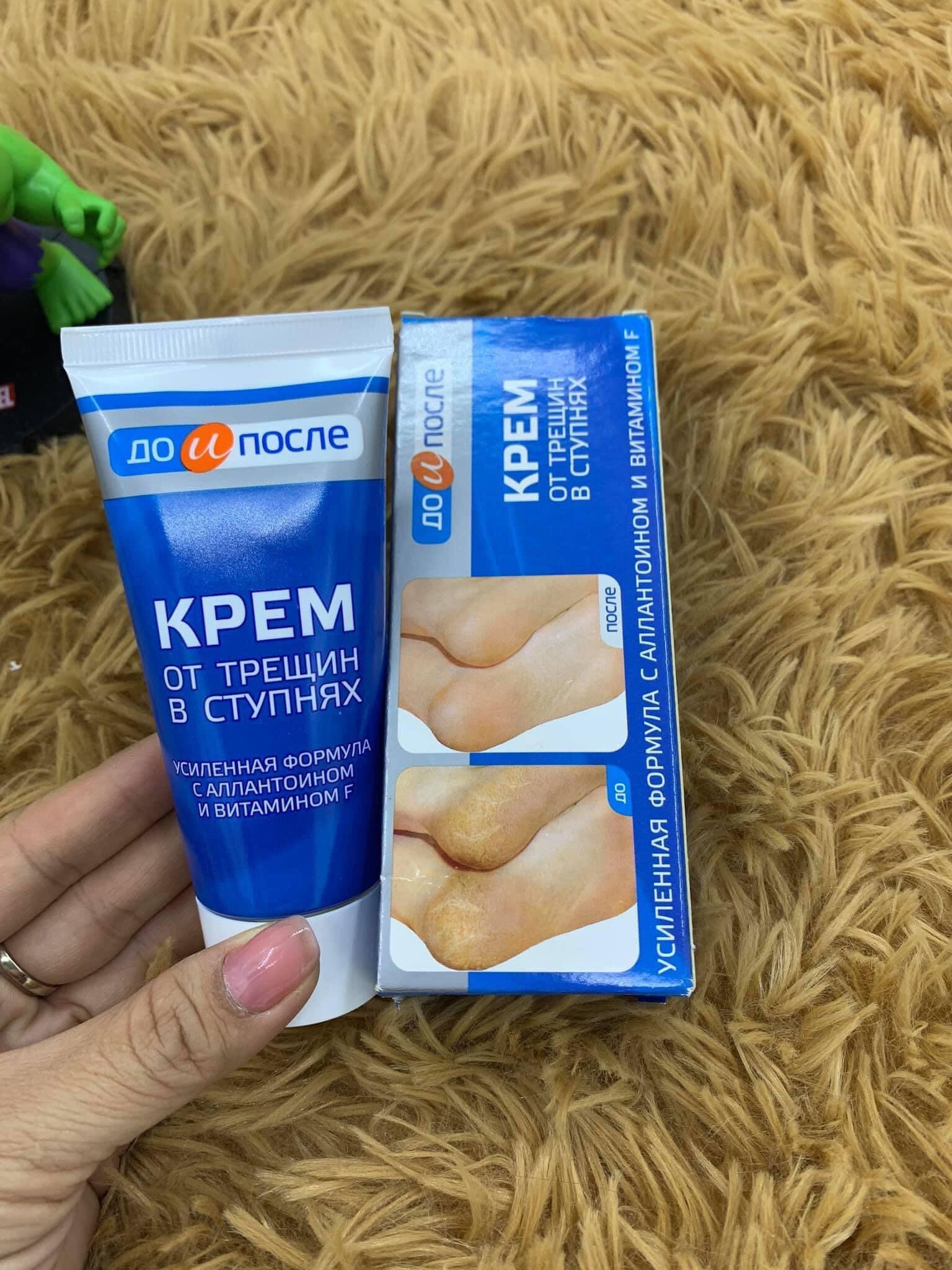 [HCM]Kem Tri Nứt Gót Chân Kpem Apteka Của Nga 50ml
