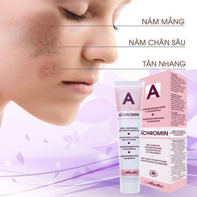 [HCM]Kem nám và tàn nhang