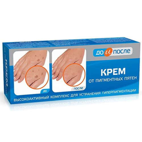 Kem giảm đồi mồi Nga