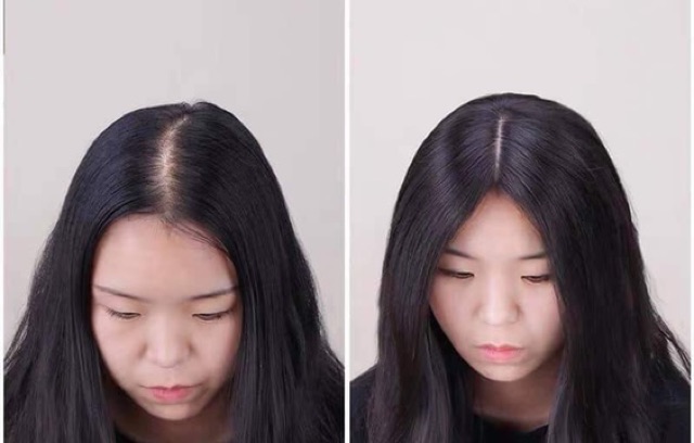 Tóc che hói/ Tóc giả che hói mái dài- tơ cao cấp