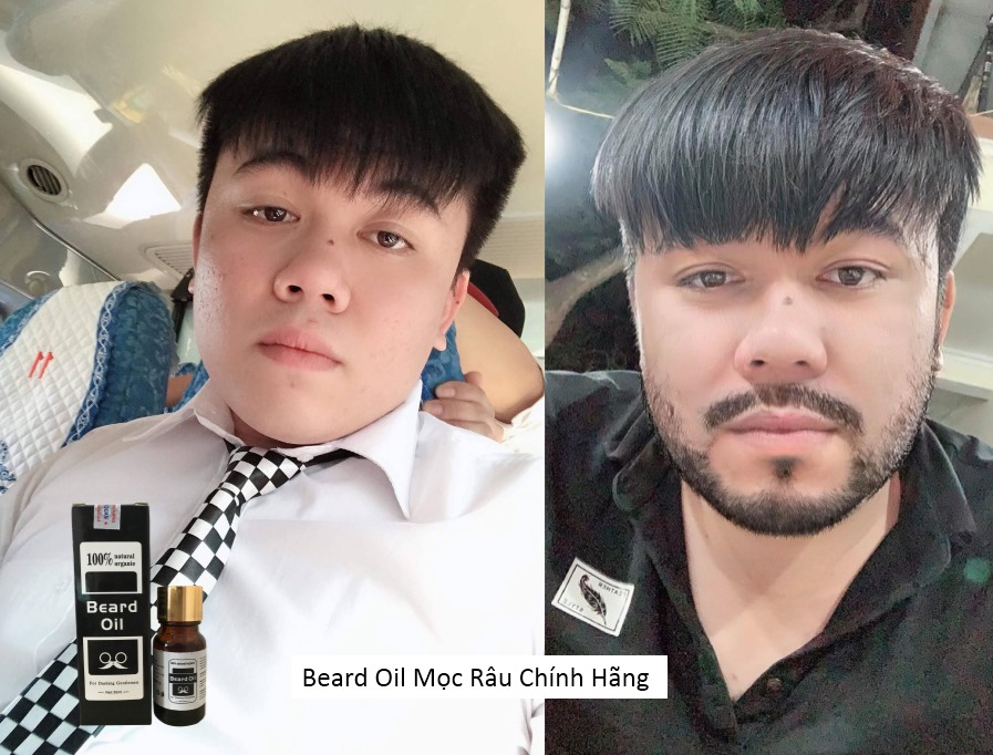 Mọc Râu Mọc Tóc Mọc Lông Mày Beard Oil