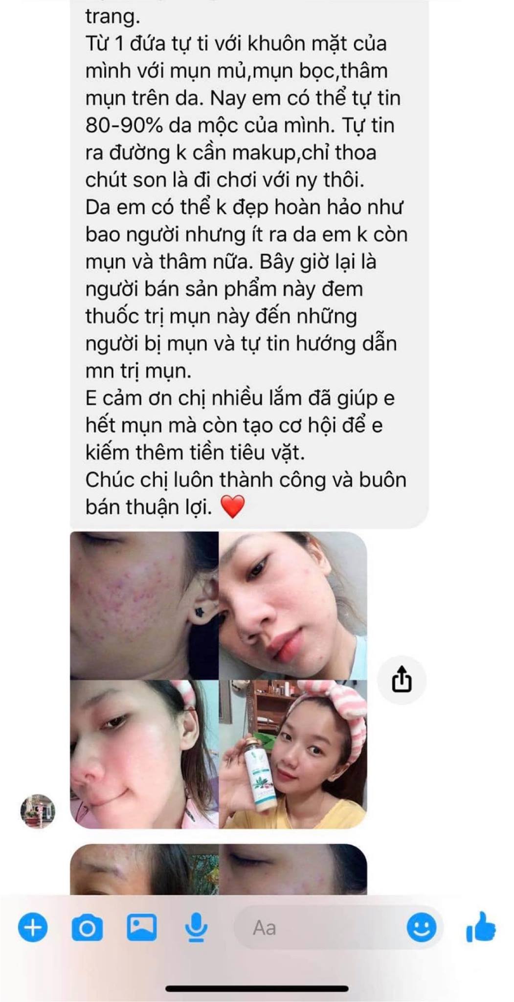 Combo 3 Chai thuoc bac tái tạo da hết mặt mụn lưng 2024 [125ML tặng kèm lọ giảm đỏ]