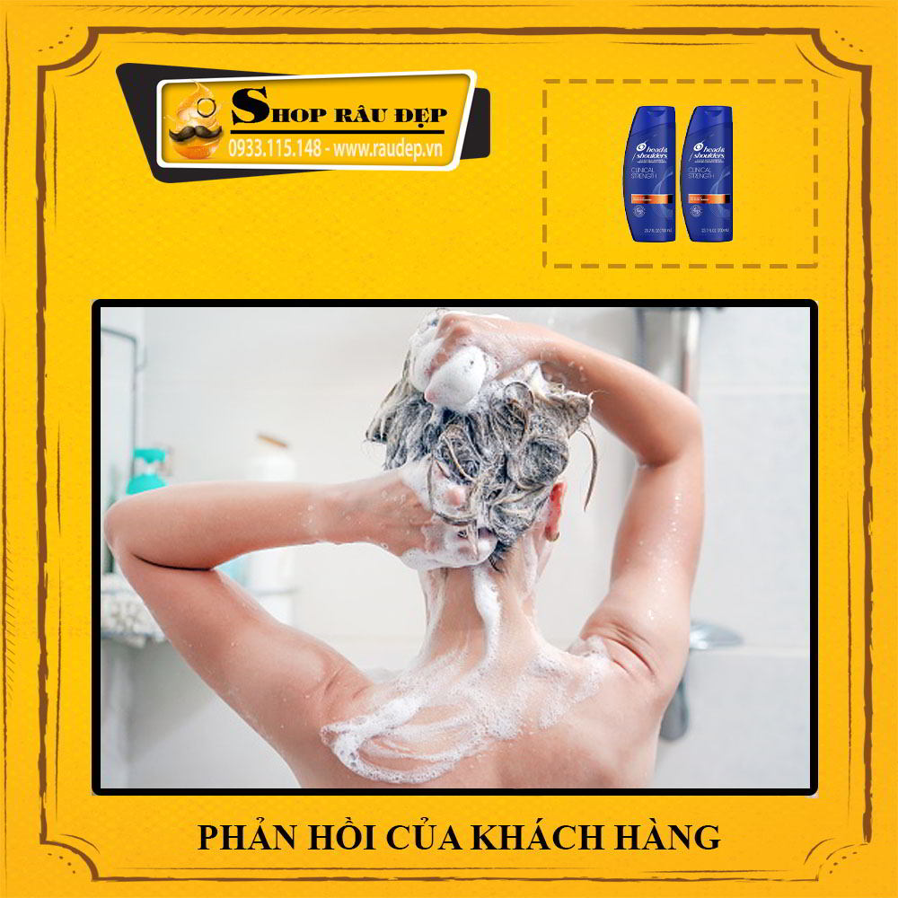 (MẪU MỚI) Dầu Gội Head and Shoulders của Mỹ
