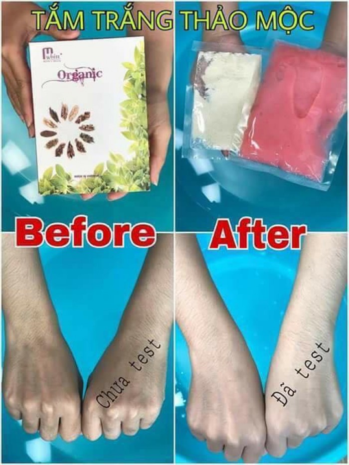 [HCM]Tắm trắng thảo mộc mwhite