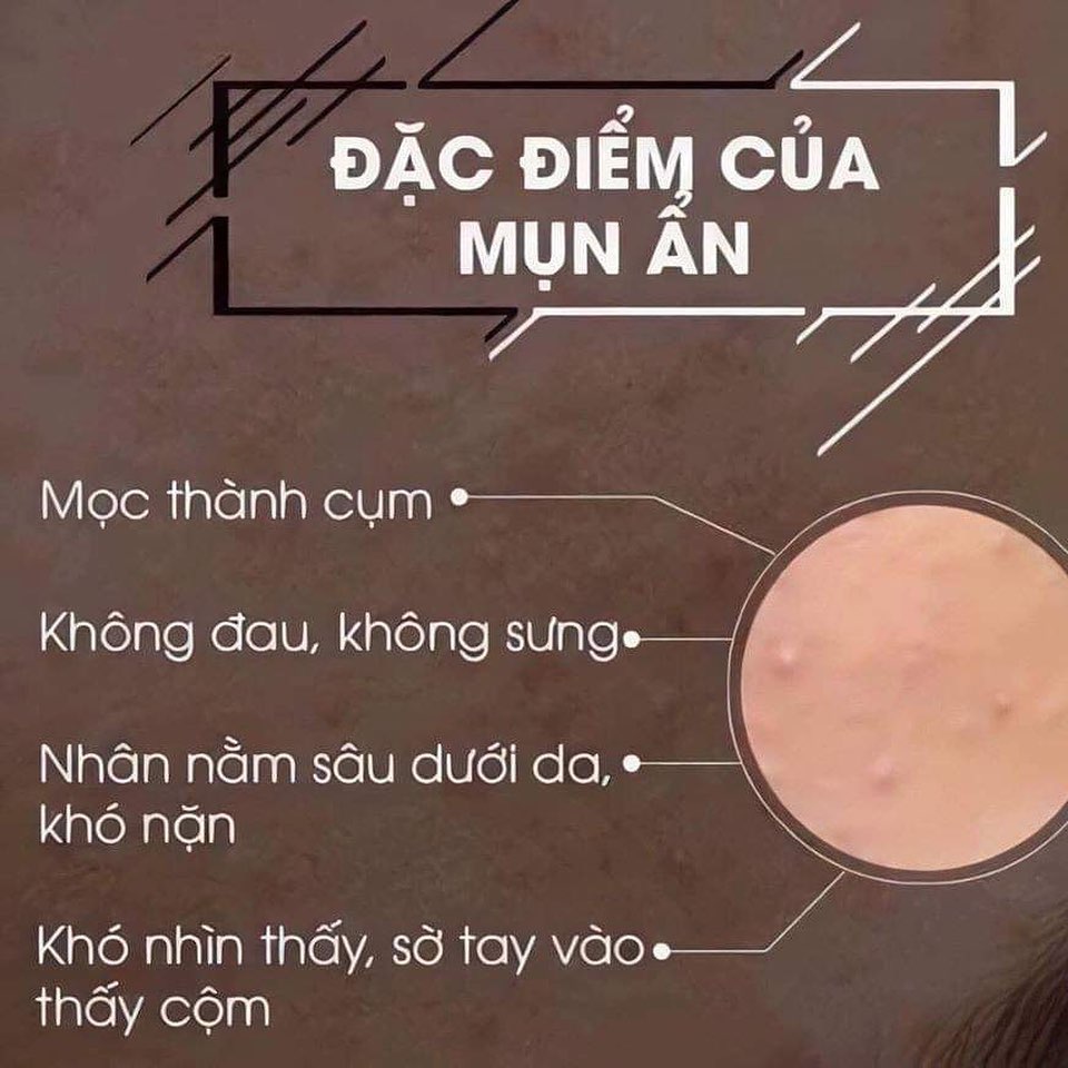 BỘT RỬA MẶT THẢO DƯỢC NGỌC LINH SÂM (150gr)