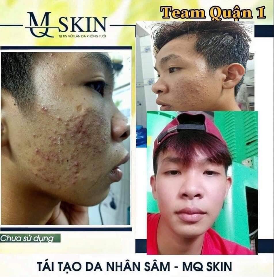 Thay Da Nhân Sâm Mq Skin[Chính Hãng]