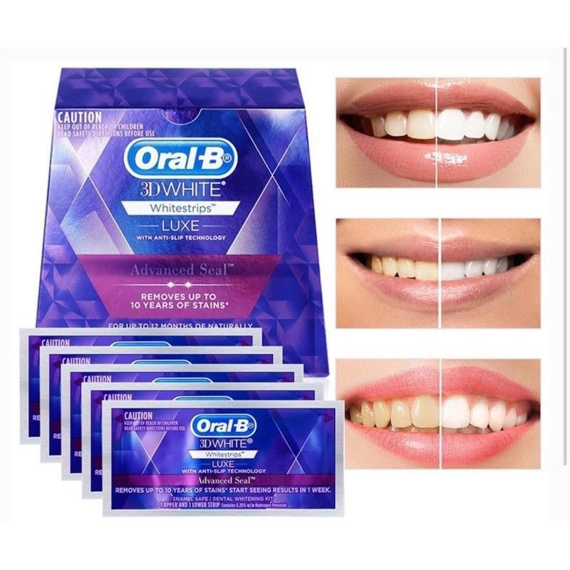 Miếng dán tẩy trắng răng Oral-B 3D White Whitestrips (1 hộp 14 miếng )
