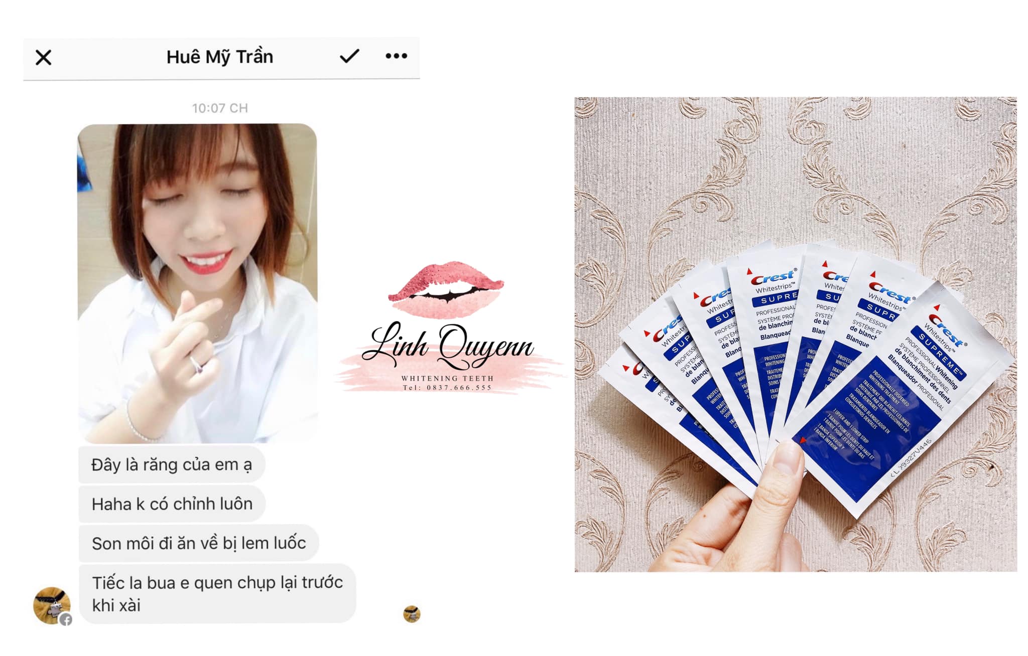 MIẾNG DÁN TRẮNG RĂNG Crest Supreme Professional