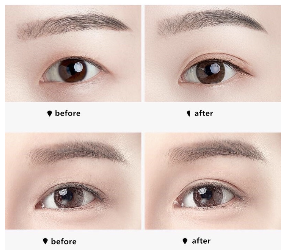 Miếng Dán Mí Miếng Kích Mí Vân Lưới Tự Nhiên Không Lộ