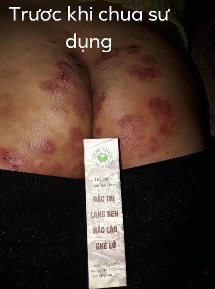 Lan Beng Trần Kim Huyền[Chính Hãng]