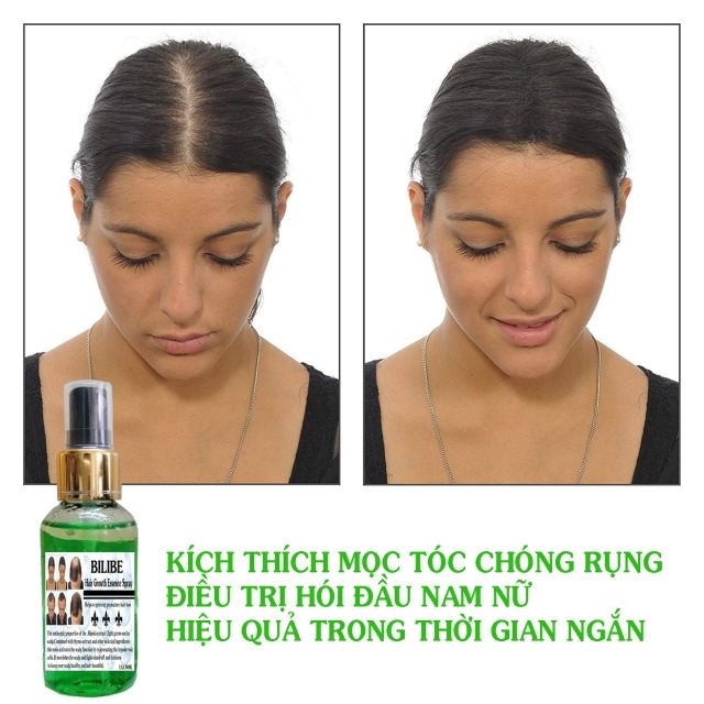 [HCM]Serum Mọc Tóc Dài Tóc Nam Nữ