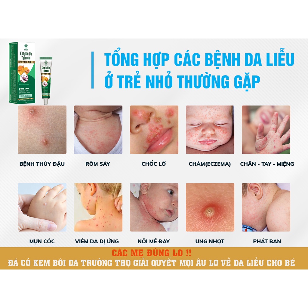 KEM BÔI DA THẢO DƯỢC SINORI