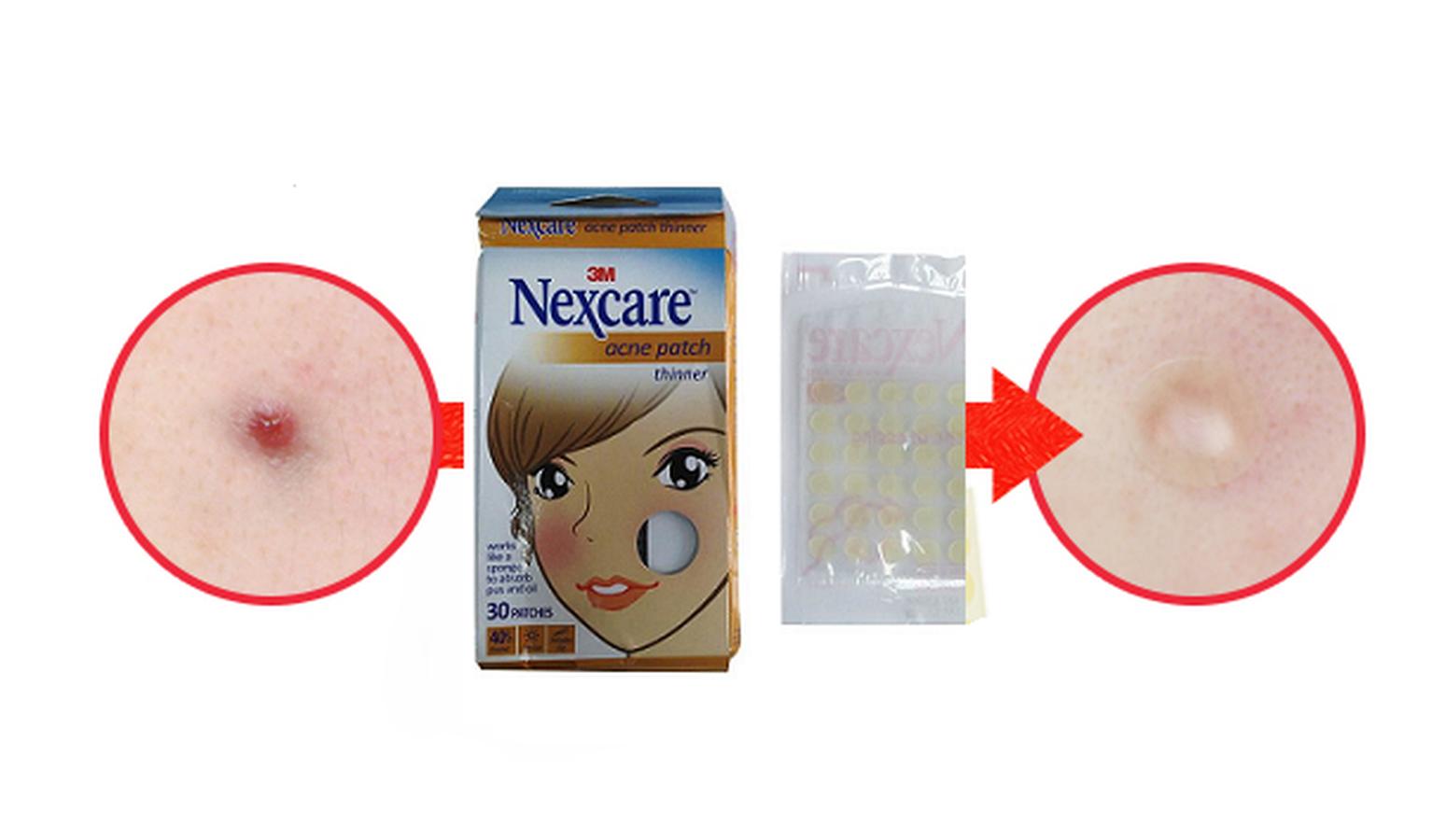 MIẾNG DÁN MỤN NEXCARE ( HỘP/30 MIẾNG)