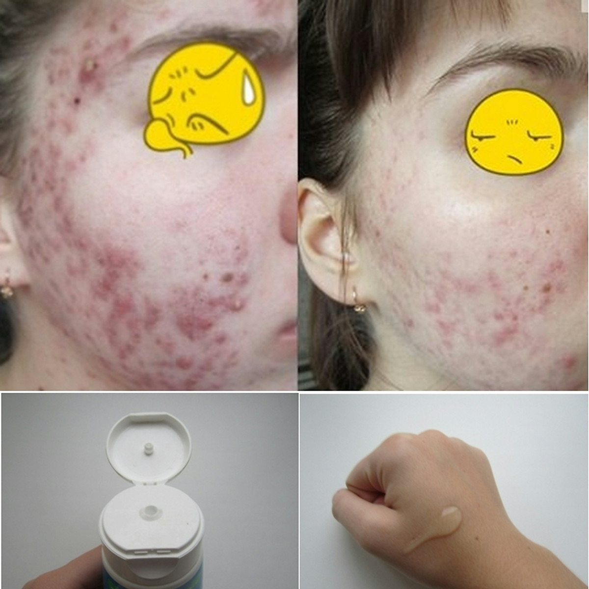 Gel rửa mặt sạch mụn sáng da Propeller Immuno 150ml