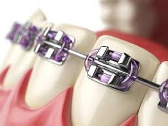 Máy tăm nước du lịch Cao cấp Procare A6