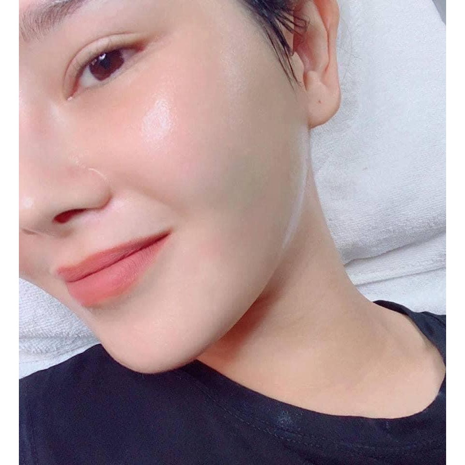 Cấy Trắng Collagen Trắng Mịn Da - Cao Cấp