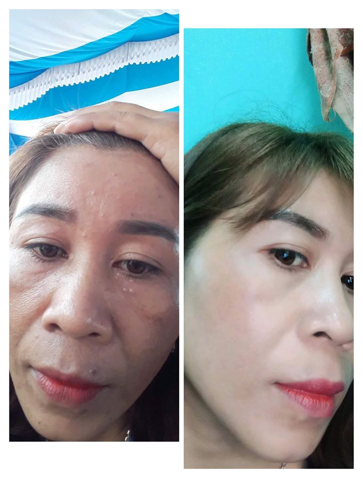 KEM DƯỠNG TRẮNG TẾ BÀO GỐC HÀN QUỐC