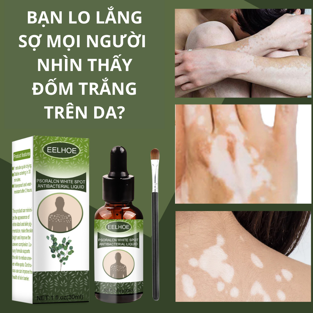 Tinh chất loại bỏ biến tận gốc, hỗ trợ dứt điểm lang ben, bạch biến hắc lào trả lại làn da khỏe mạnh đều màu, phục hồi sắc tố da hiệu quả nhanh chóng trong 7 ngày