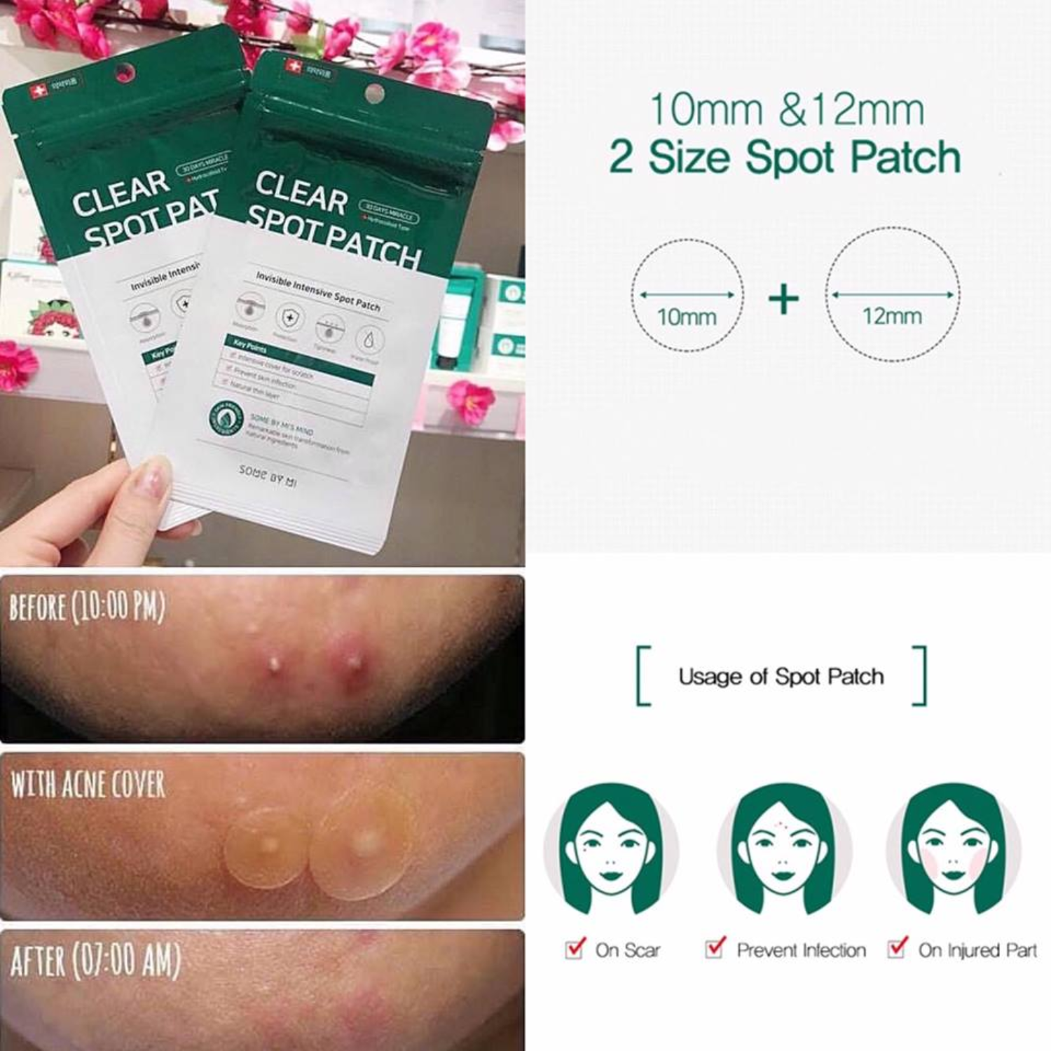 Miếng Dán Mụn Some By Mi Clear Spot Patch 18 miếng