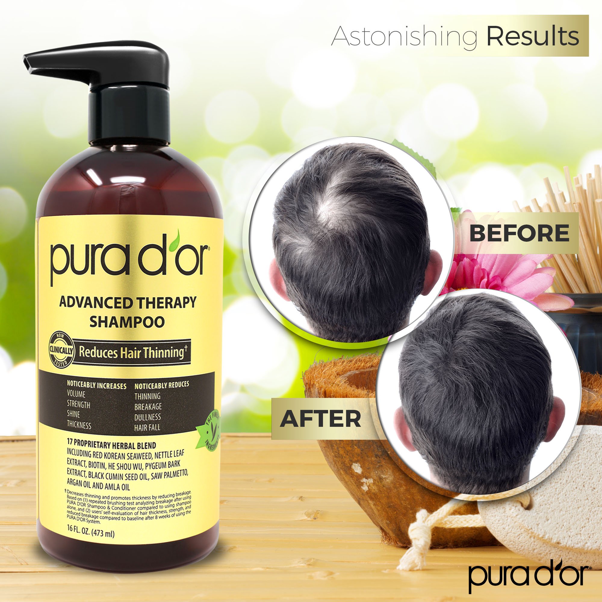 [HCM]PURA DOR ADVANCED THERAPY SHAMPOO / DẦU GỘI LÀM DÀY TÓC 473ML