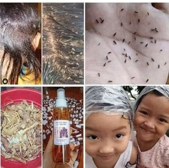 Dầu gội sạch chấy chí. ủ chấy chí. dầu gội diệt chấy chí và trứng cho bé. tặng mũ ủ chấy tiện dụng gia truyền ❤ cam kết hiệu quả 100%