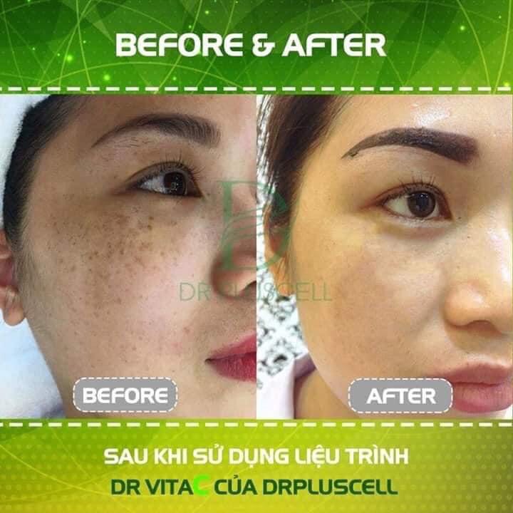 Tế bào gốc giảm thâm nám, trắng da Dr VitaC